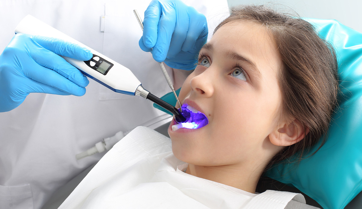 ddf-sealants-fluoride.jpg