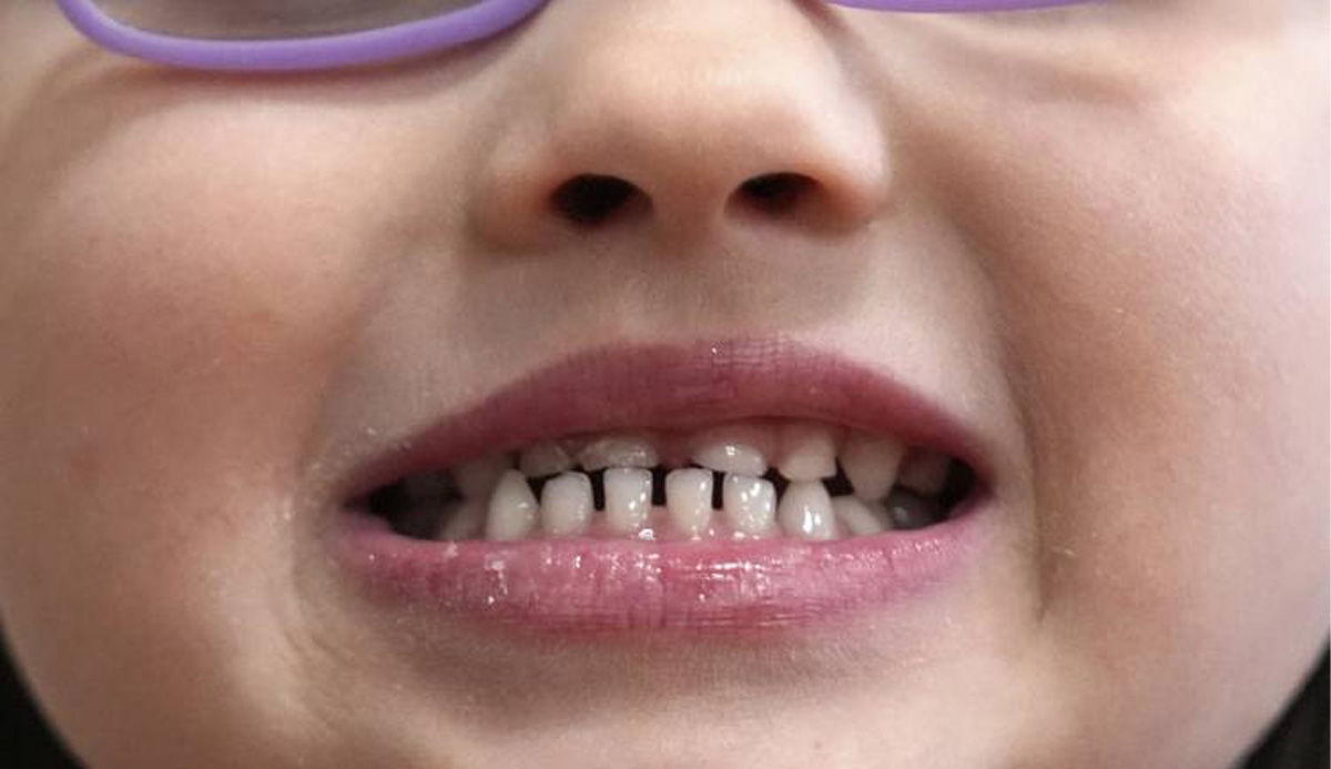 nedd-op-ed-fluoridation.jpg